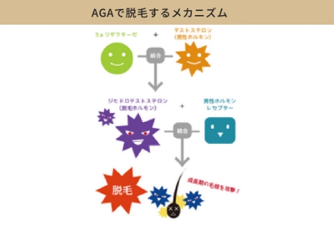 AGAのメカニズム